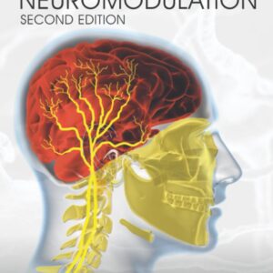 Essential Neuromodulation