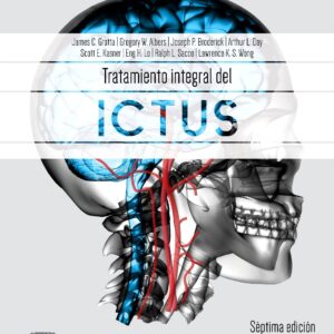 Tratamiento integral del ictus