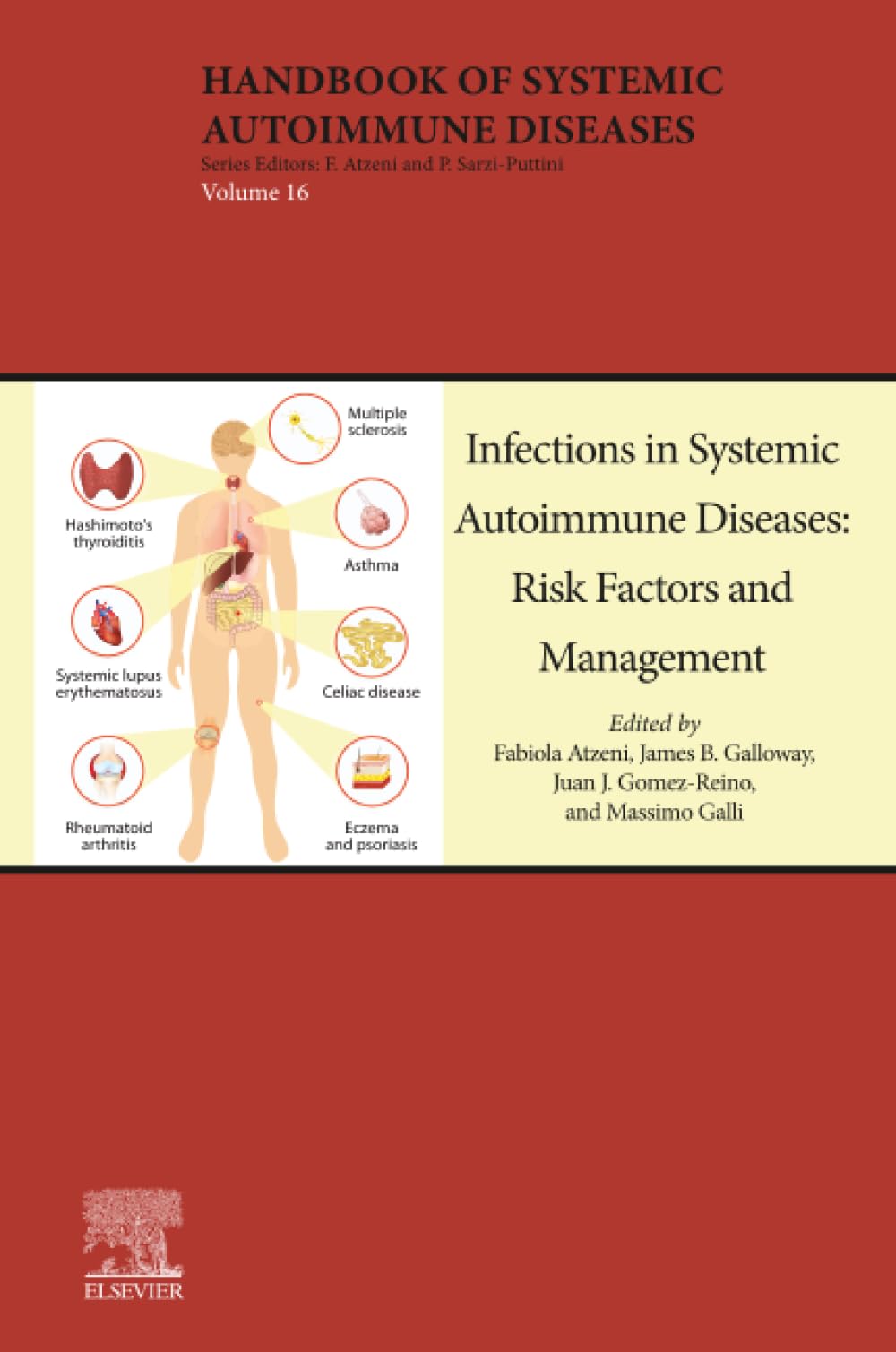 Infections in Systemic Autoimmune Diseases: Risk Factors and Management (Volume 16) (Handbook of Systemic Autoimmune Diseases