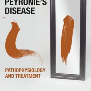 Peyronie's Disease: Pathophysiology and Treatment