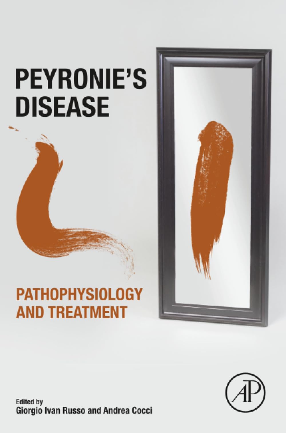 Peyronie's Disease: Pathophysiology and Treatment