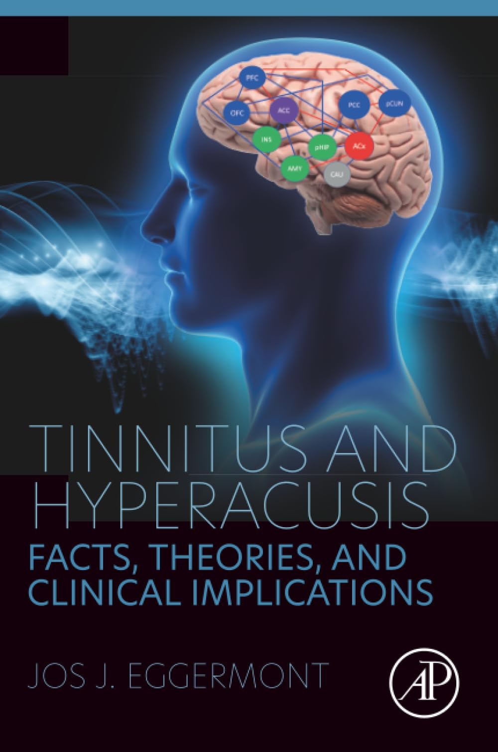 Tinnitus and Hyperacusis: Facts