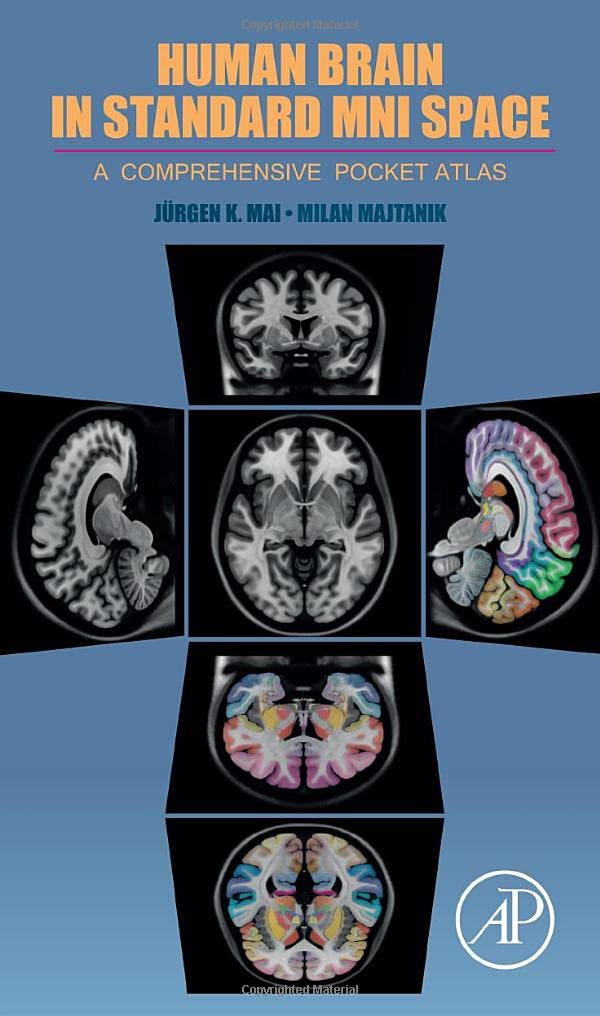 Human Brain in Standard MNI Space: A Comprehensive Pocket Atlas