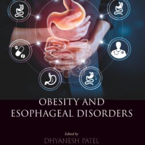 Obesity and Esophageal Disorders
