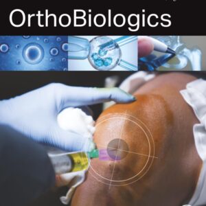 OrthoBiologics
