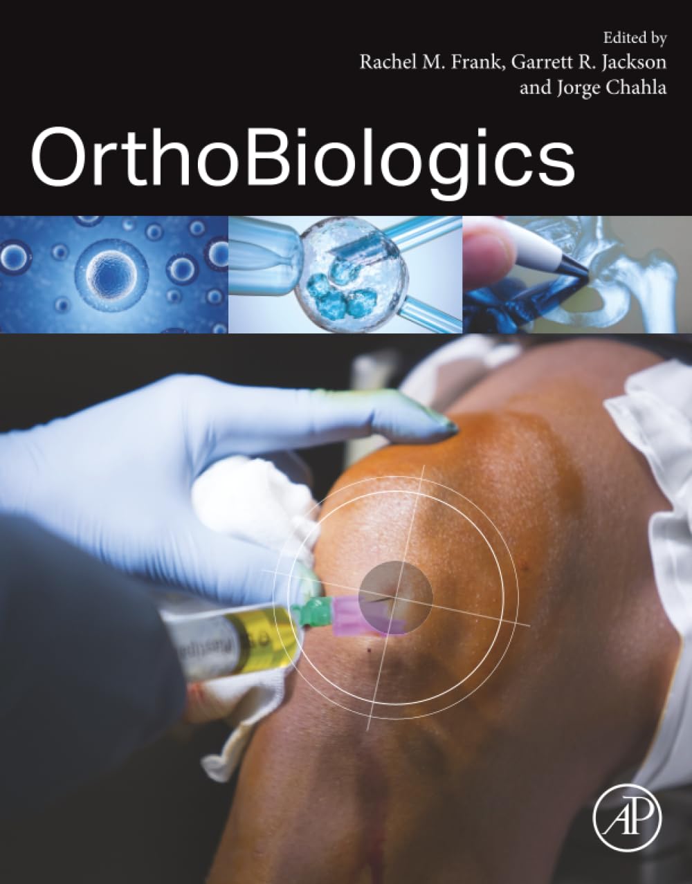 OrthoBiologics