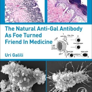 The Natural Anti-Gal Antibody as Foe Turned Friend in Medicine