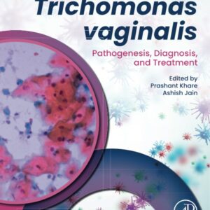 Trichomonas vaginalis: Pathogenesis