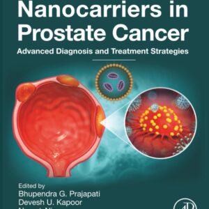 Nanocarriers in Prostate Cancer: Advanced Diagnosis and Treatment Strategies