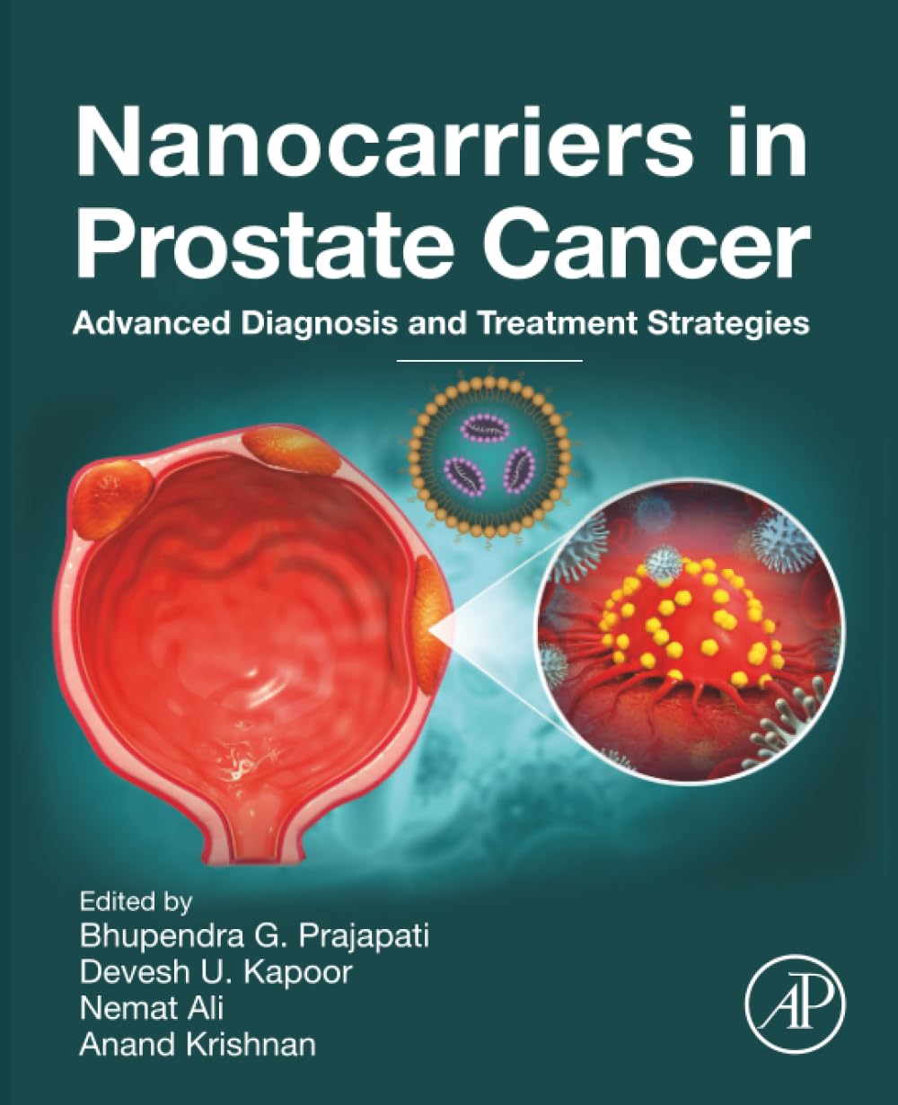 Nanocarriers in Prostate Cancer: Advanced Diagnosis and Treatment Strategies
