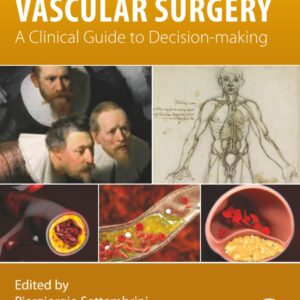 Vascular Surgery: A Clinical Guide to Decision-making
