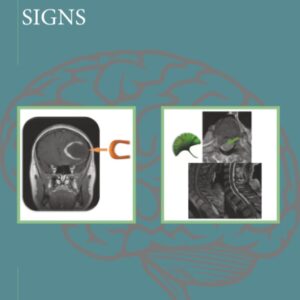 Pictorial Atlas of Neuroradiological Signs