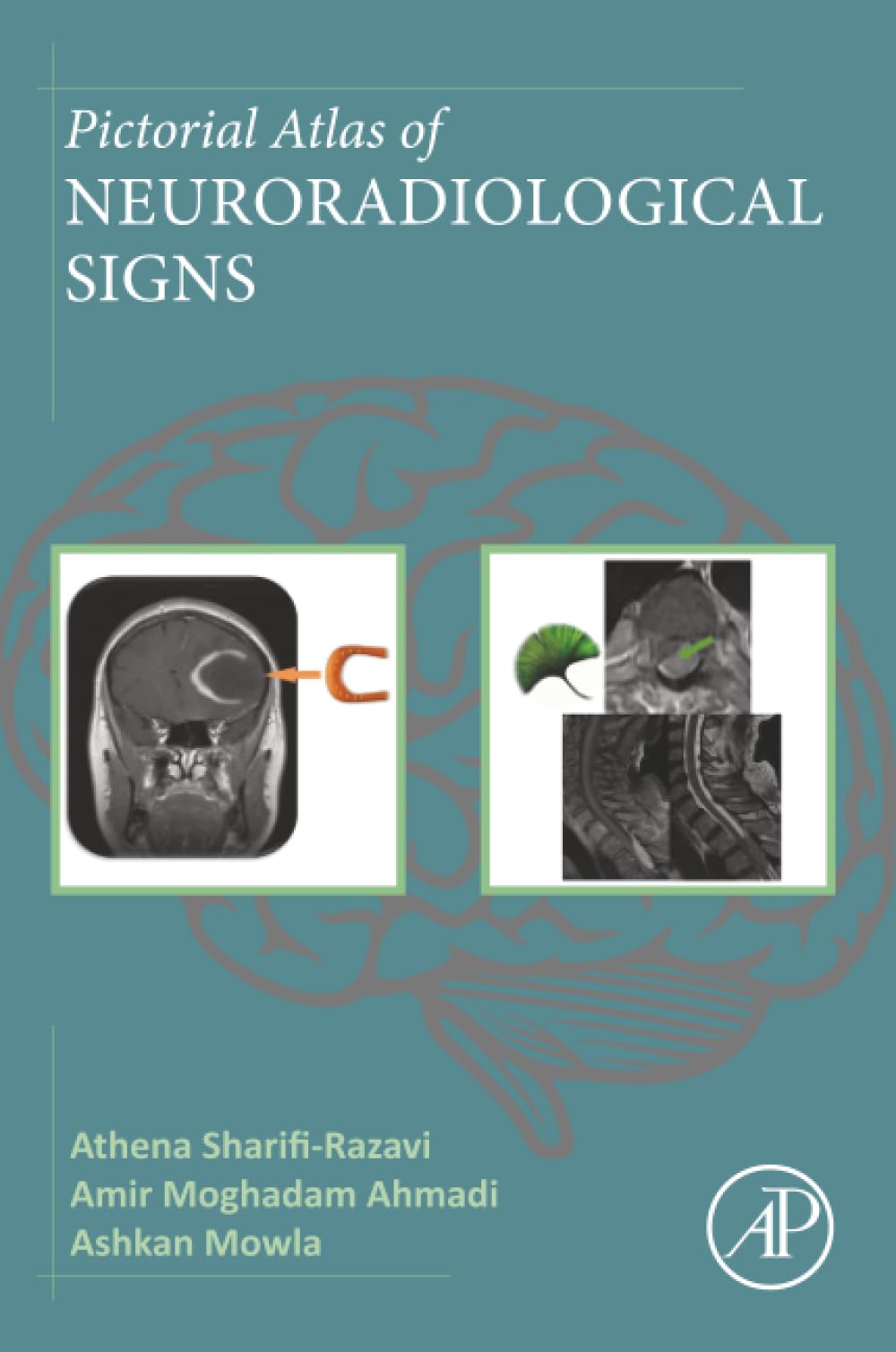 Pictorial Atlas of Neuroradiological Signs