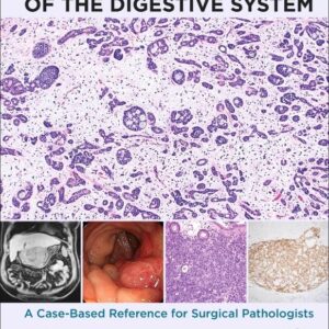 100 Rare Tumors of the Digestive System: A Case-Based Reference for Surgical Pathologists