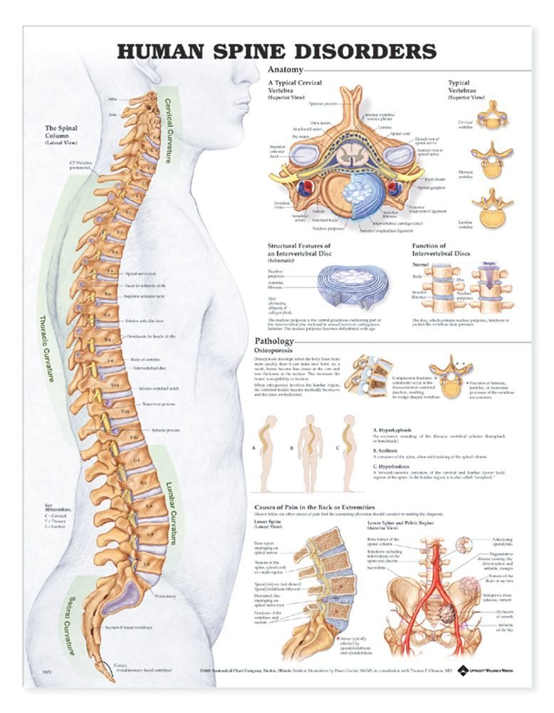 ACC Human Spine Disorders Anatomical Chart-ISBN: 433599014637