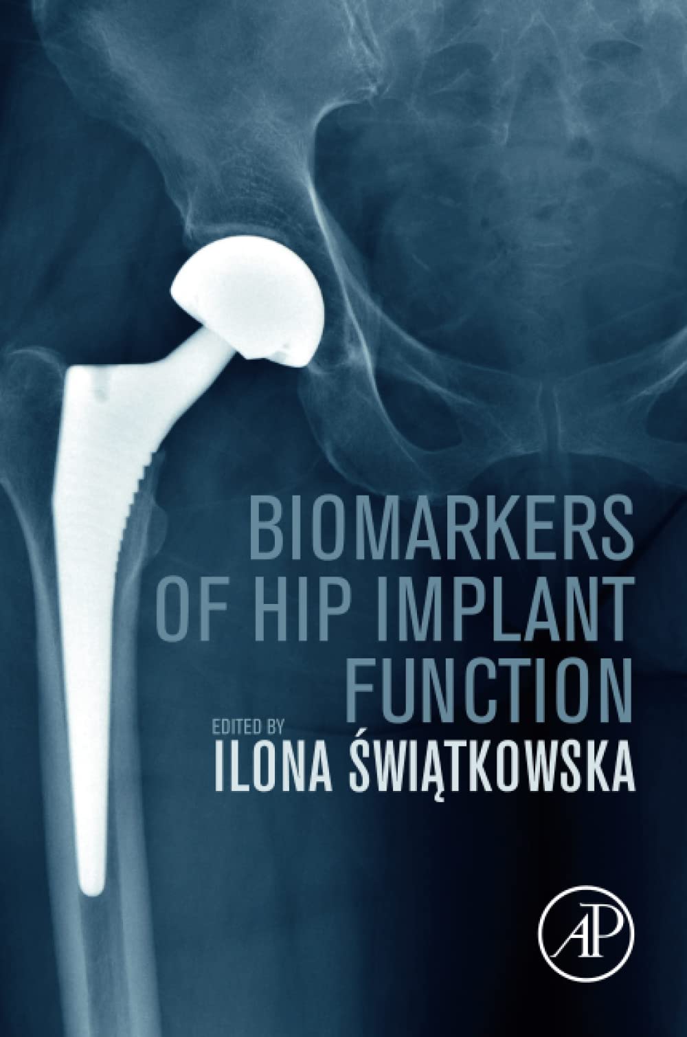 Biomarkers of Hip Implant Function: Diagnostic Modalities to Prevent Chronic Periprosthetic Joint Infection and Implant Failure