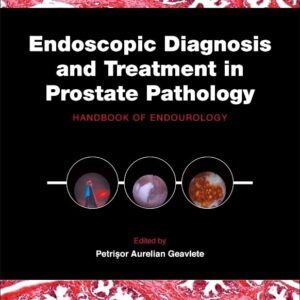 Endoscopic Diagnosis and Treatment in Prostate Pathology: Handbook of Endourology