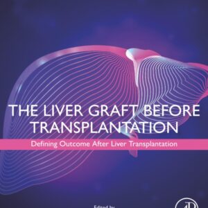 The Liver Graft Before Transplantation: Defining Outcome After Liver Transplantation
