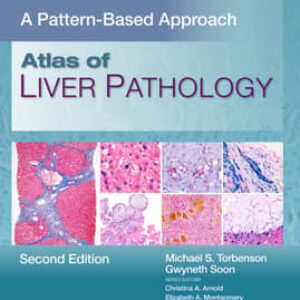 Atlas of Liver Pathology: A Pattern-Based Approach-ISBN: 9781975240110