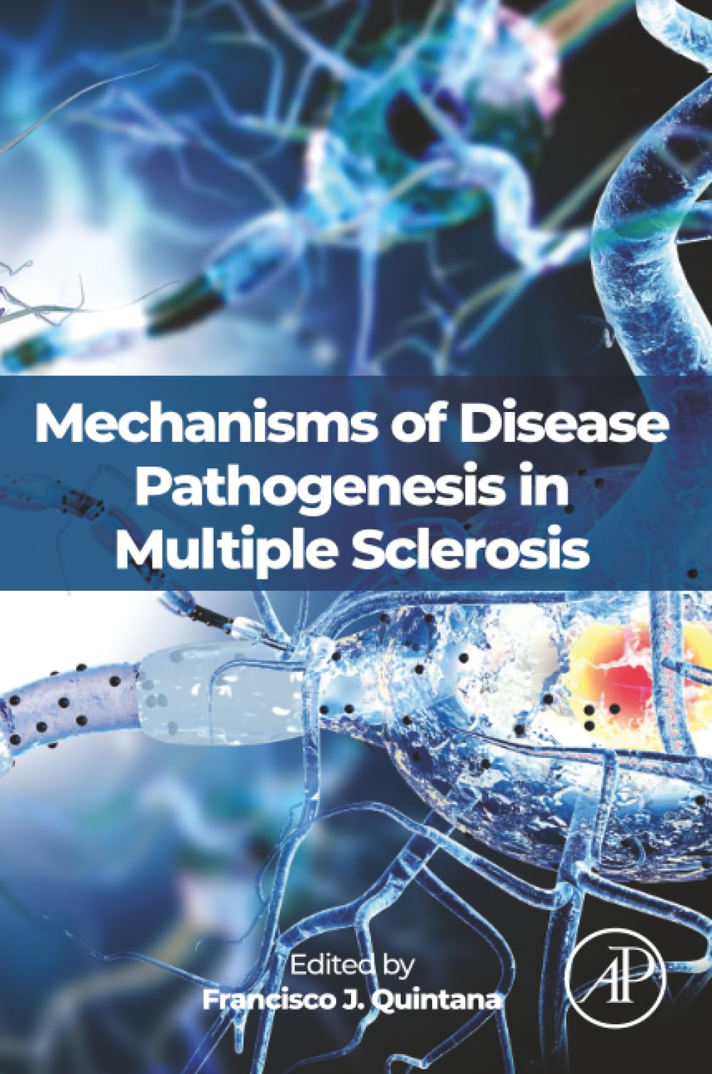 Mechanisms of Disease Pathogenesis in Multiple Sclerosis