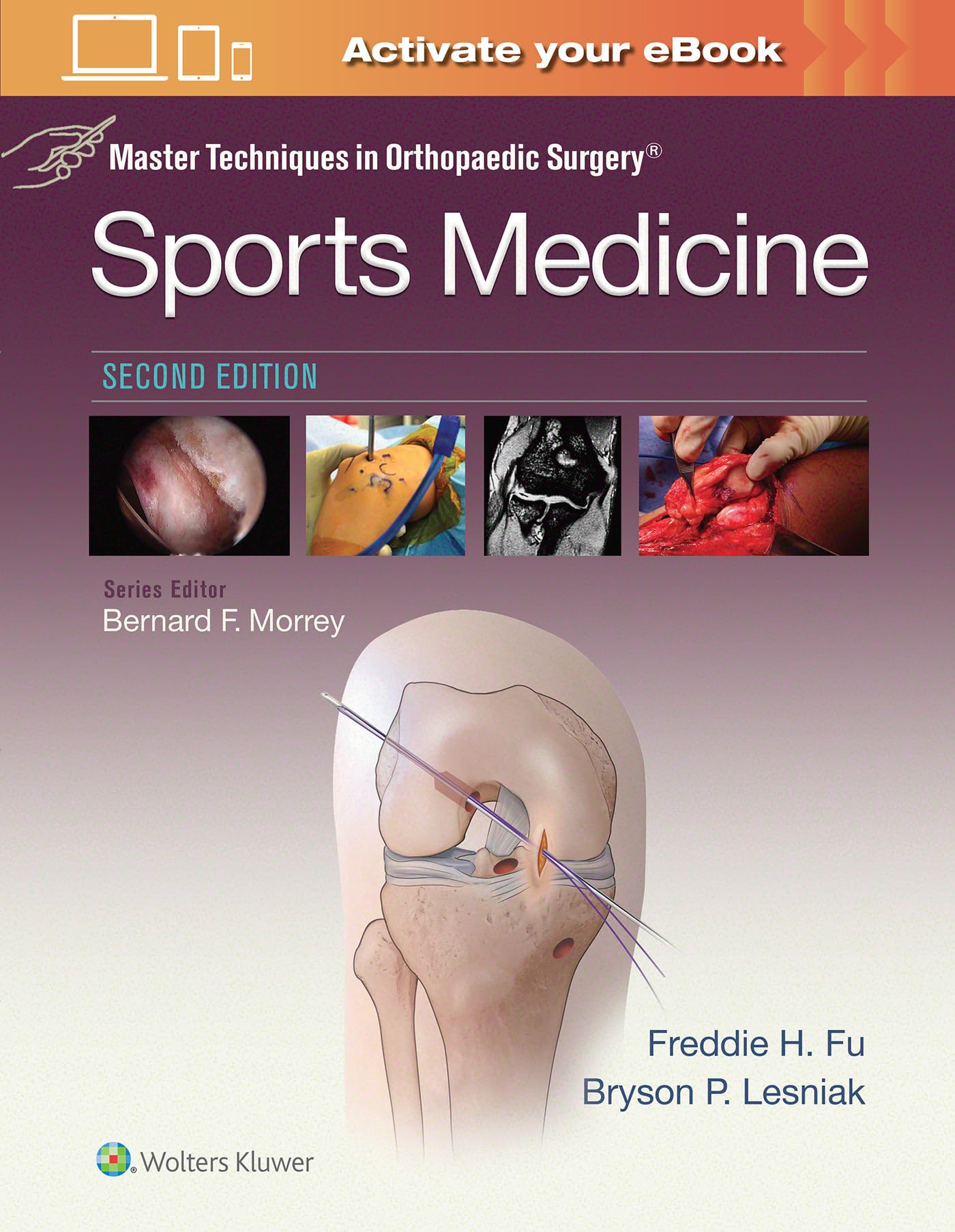 Master Techniques in Orthopaedic Surgery: Sports Medicine-ISBN: 9781496375179