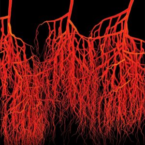 Regenerative Medicine for Peripheral Artery Disease