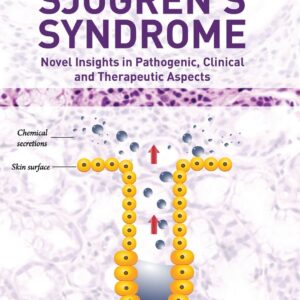Sjogren's Syndrome: Novel Insights in Pathogenic