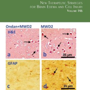 New Therapeutic Strategies for Brain Edema and Cell Injury (Volume 146) (International Review of Neurobiology