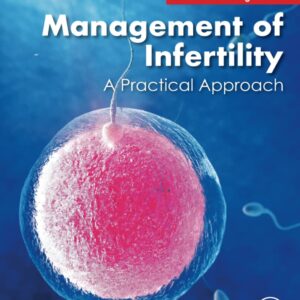 Management of Infertility: A Practical Approach