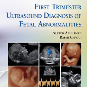 First Trimester Ultrasound Diagnosis of Fetal Abnormalities-ISBN: 9781451193725