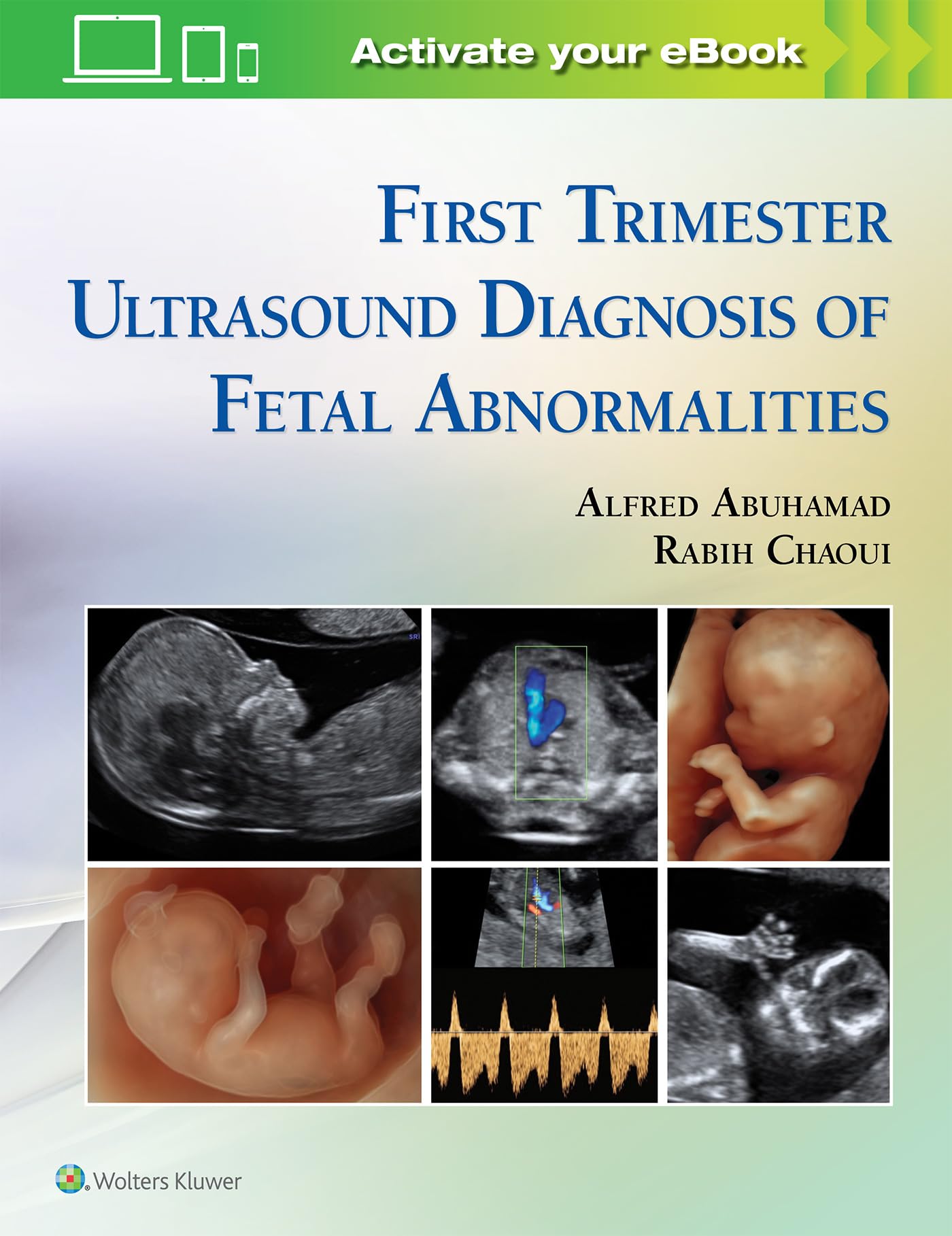 First Trimester Ultrasound Diagnosis of Fetal Abnormalities-ISBN: 9781451193725