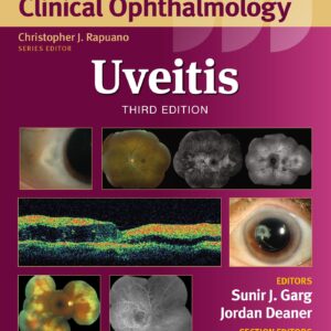 Uveitis (Wills Eye Institute Atlas Series)-ISBN: 9781975215194