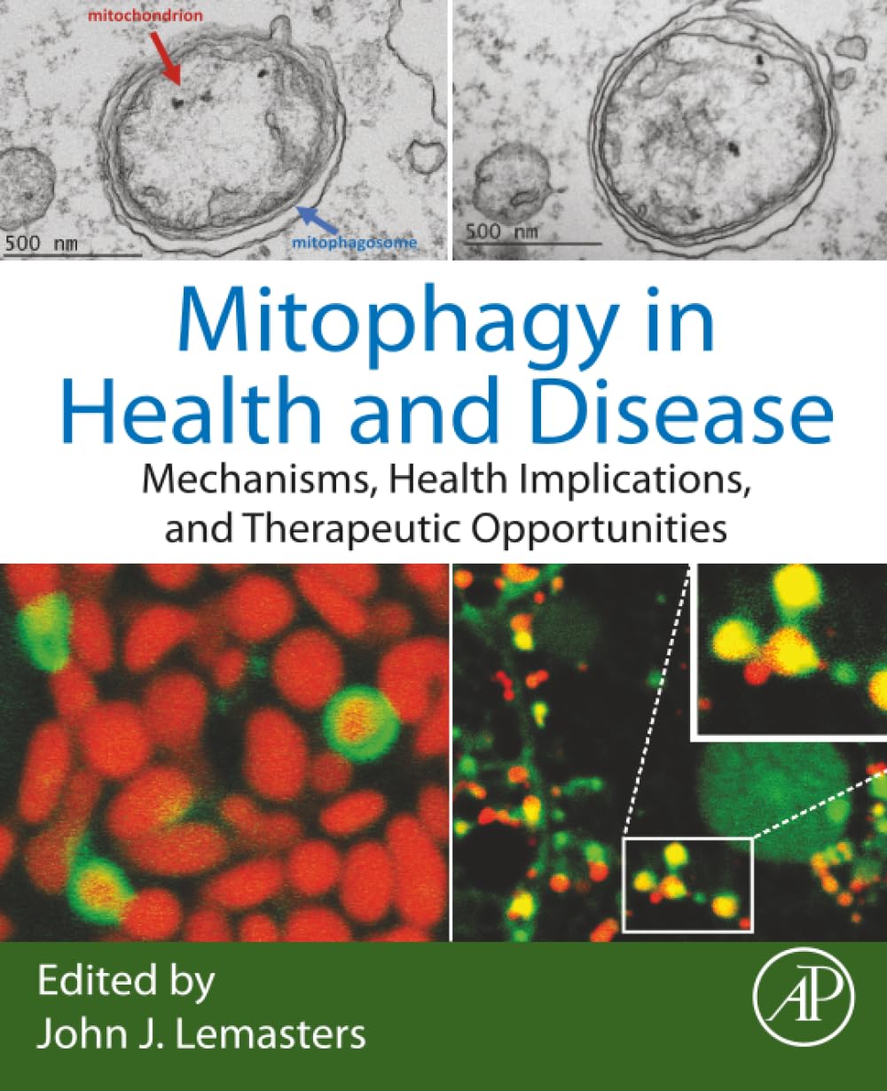 Mitophagy in Health and Disease: Mechanisms