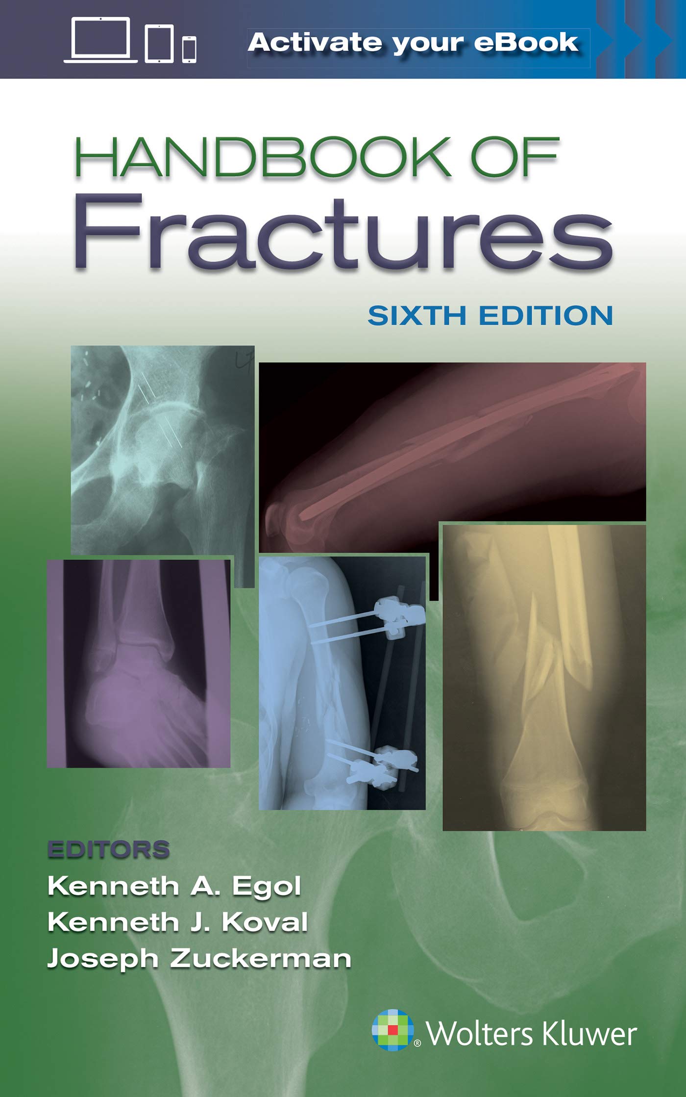 Handbook of Fractures-ISBN: 9781496384850