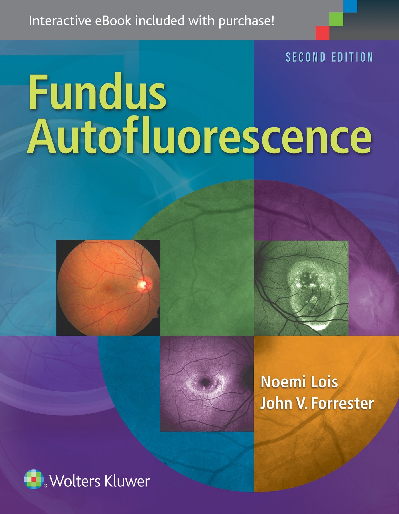 Fundus Autofluorescence-ISBN: 9781451194593