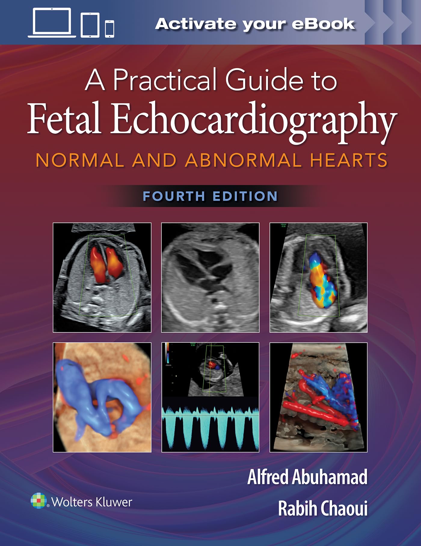 A Practical Guide to Fetal Echocardiography: Normal and Abnormal Hearts-ISBN: 9781975126810