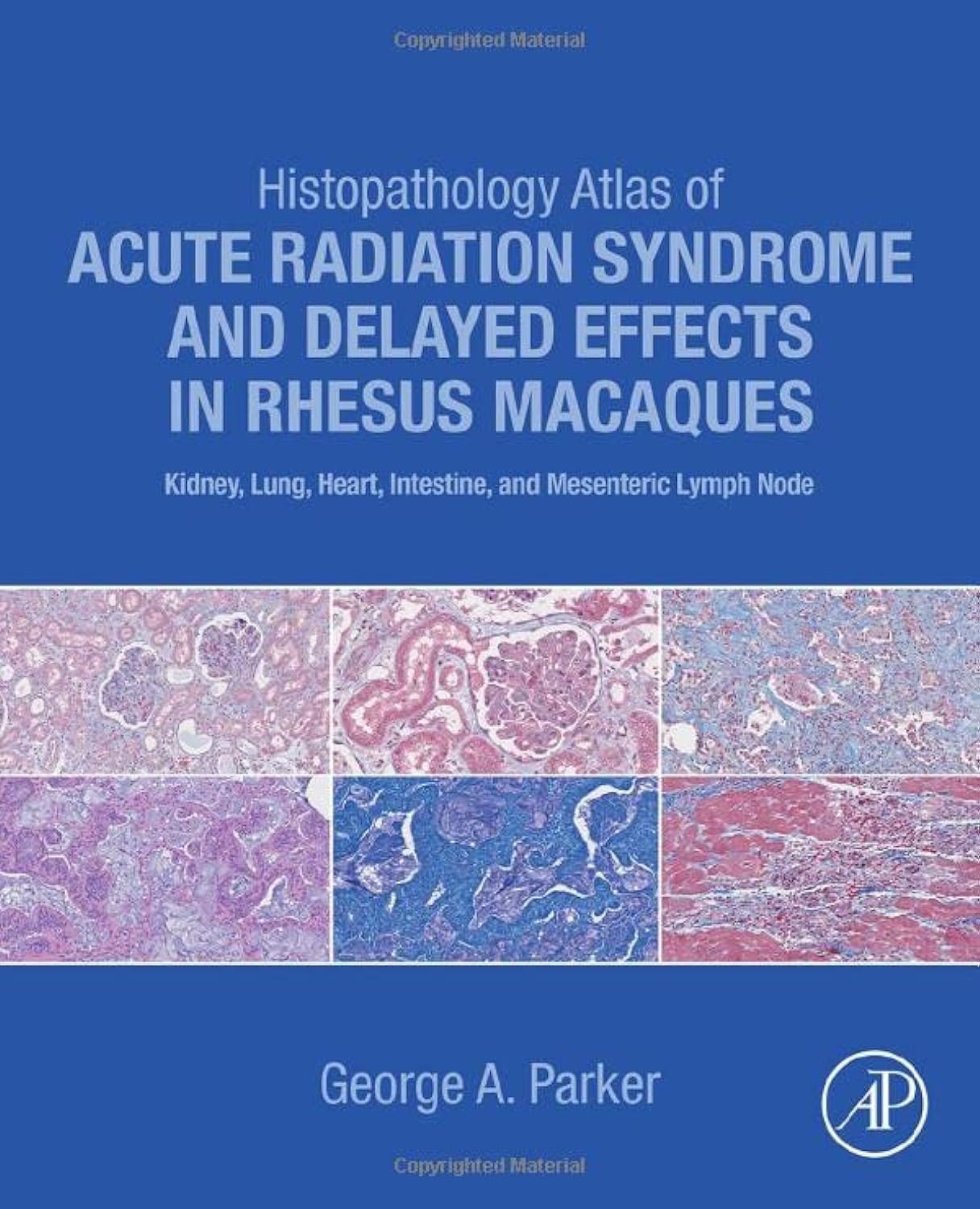Histopathology Atlas of Acute Radiation Syndrome and Delayed Effects in Rhesus Macaques: Kidney