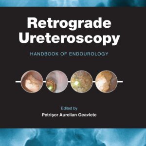 Retrograde Ureteroscopy: Handbook of Endourology