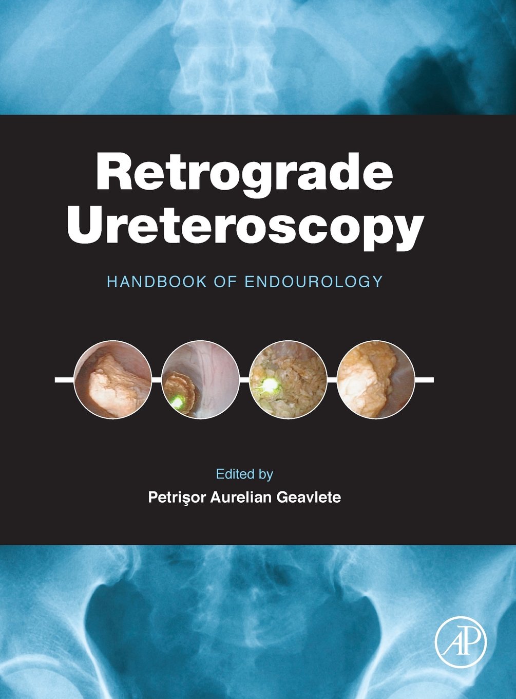Retrograde Ureteroscopy: Handbook of Endourology