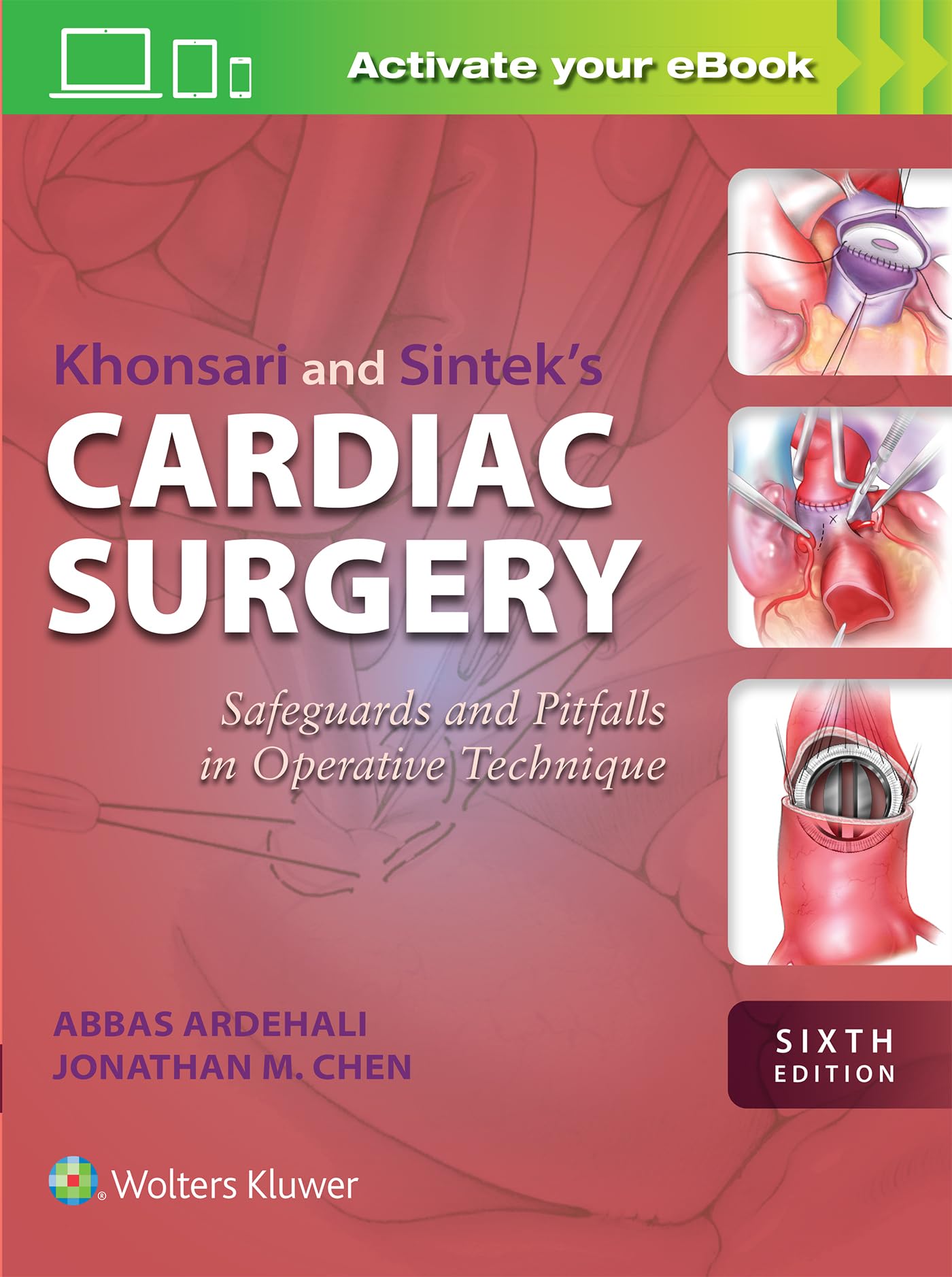 Khonsari and Sintek's Cardiac Surgery: Safeguards and Pitfalls in Operative Technique-ISBN: 9781975238391