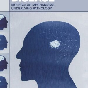 Parkinson's Disease: Molecular Mechanisms Underlying Pathology