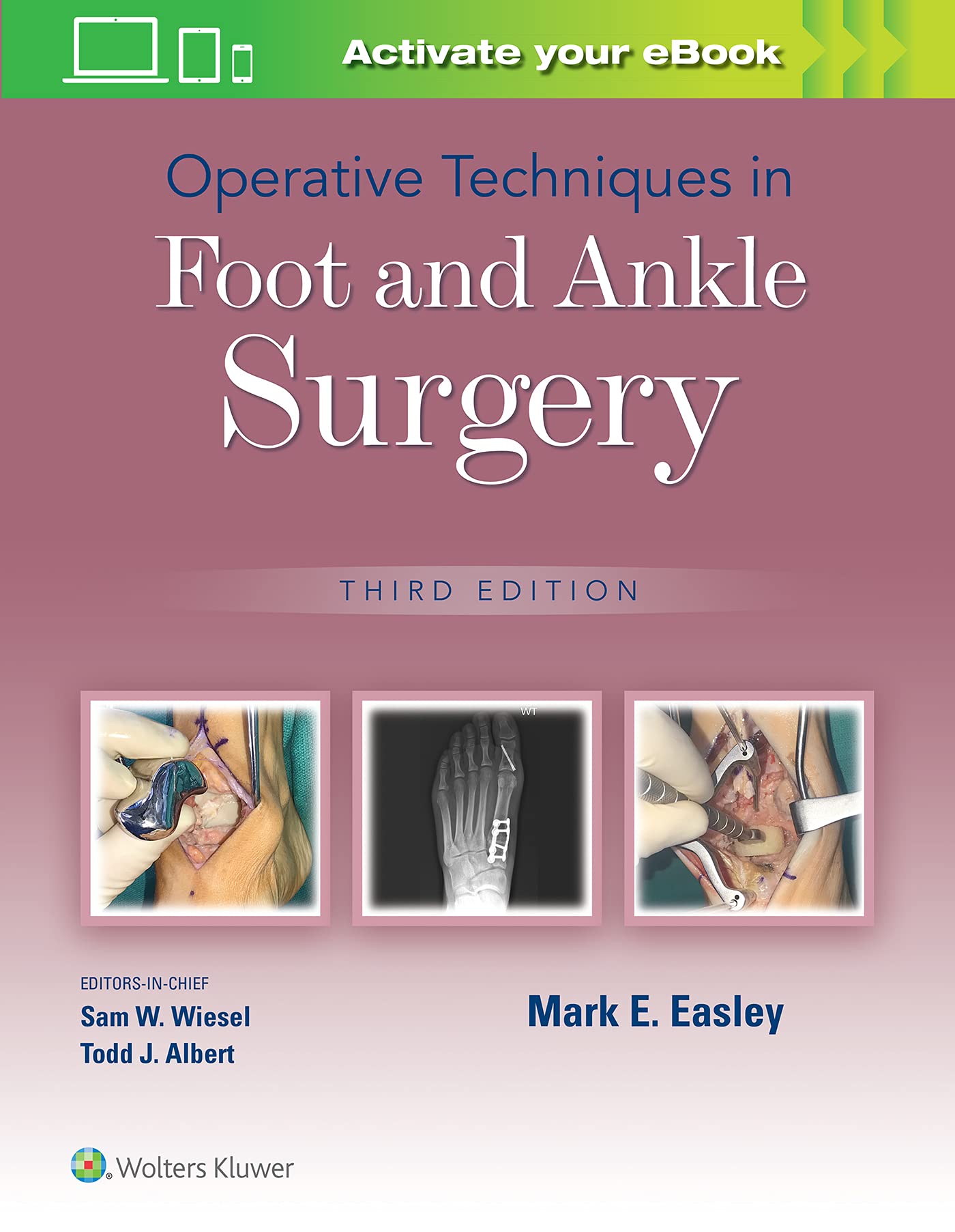 Operative Techniques in Foot and Ankle Surgery-ISBN: 9781975172114