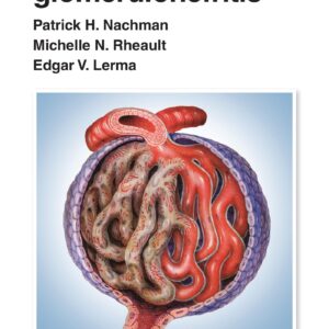 Manual de glomerulonefritis (Spanish Edition)-ISBN: 9788419663160