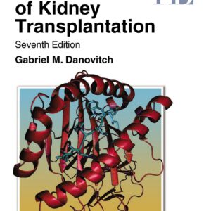 Handbook of Kidney Transplantation-ISBN: 9781975216153
