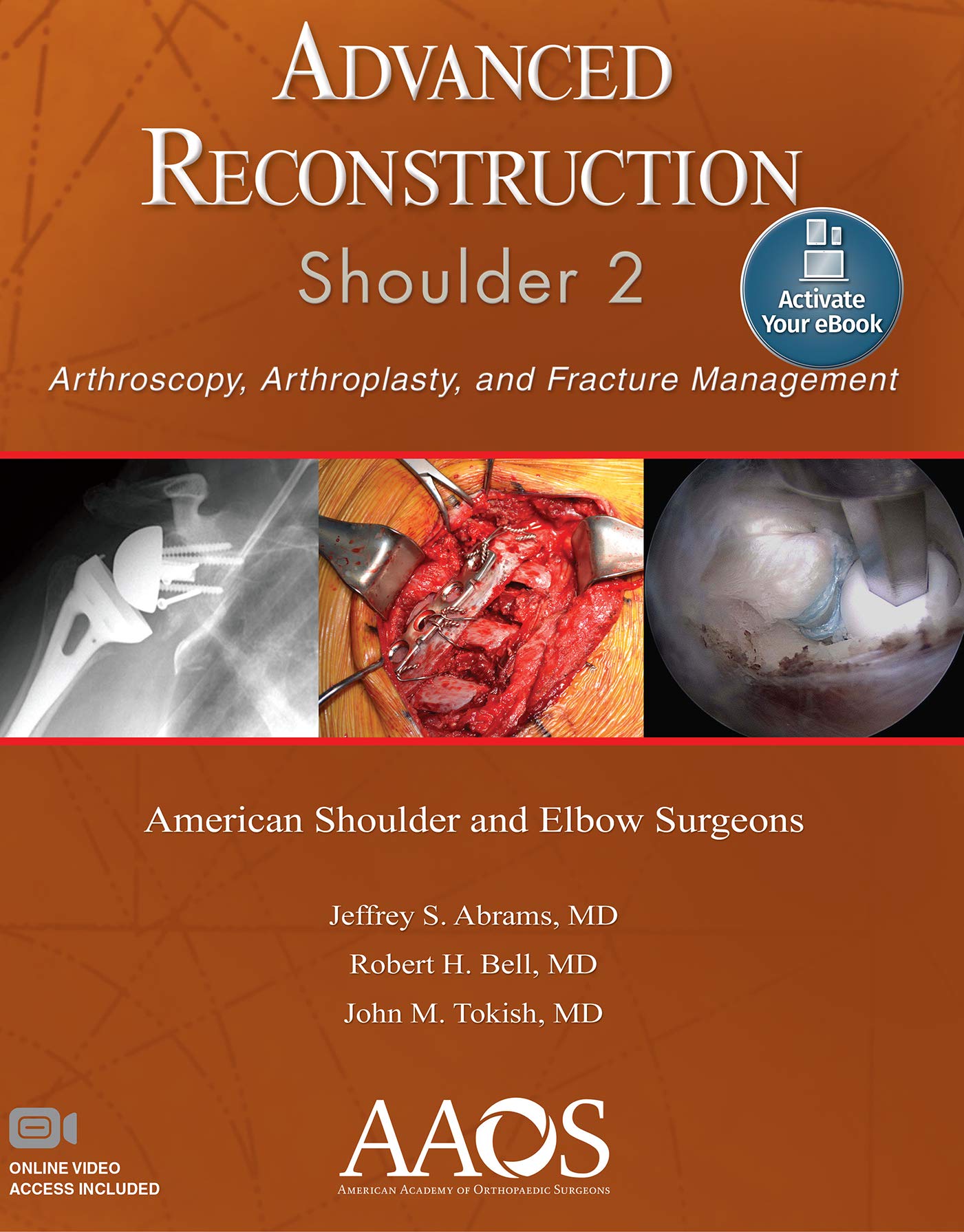 Advanced Reconstruction: Shoulder 2: Print + Ebook with Multimedia (AAOS - American Academy of Orthopaedic Surgeons)-ISBN: 9781975123475