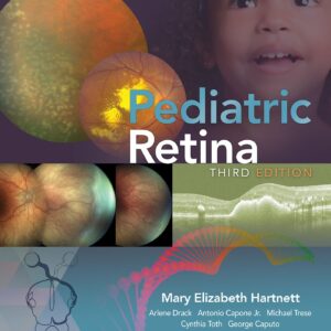 Pediatric Retina-ISBN: 9781975110710
