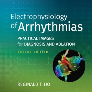Electrophysiology of Arrhythmias: Practical Images for Diagnosis and Ablation-ISBN: 9781975101107