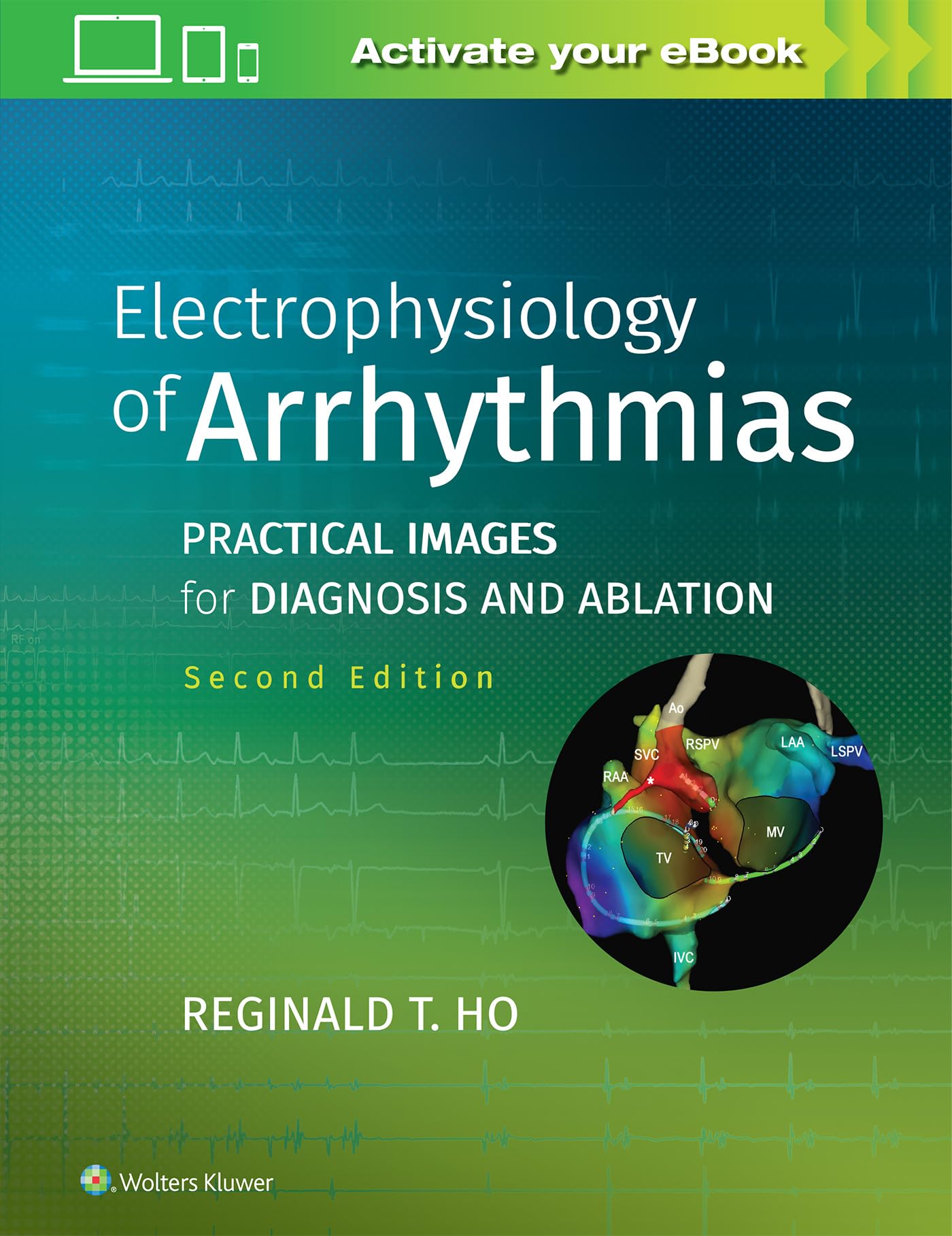 Electrophysiology of Arrhythmias: Practical Images for Diagnosis and Ablation-ISBN: 9781975101107