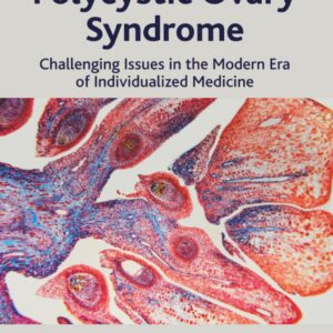 Polycystic Ovary Syndrome: Challenging Issues in the Modern Era of Individualized Medicine