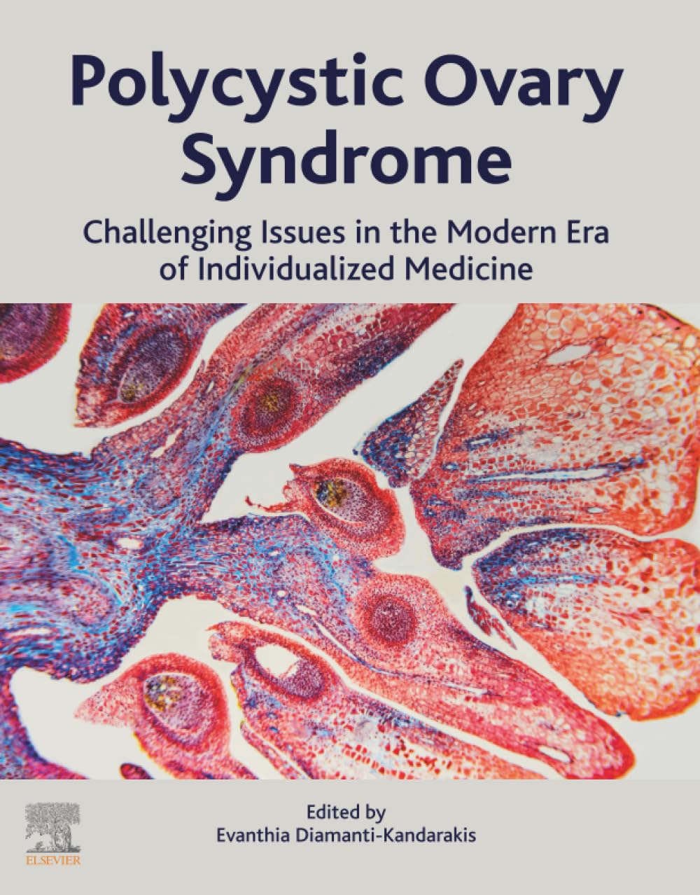 Polycystic Ovary Syndrome: Challenging Issues in the Modern Era of Individualized Medicine